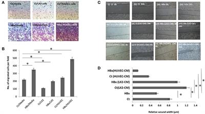 Endothelial Cell-Derived TGF-β Promotes Epithelial-Mesenchymal Transition via CD133 in HBx-Infected Hepatoma Cells